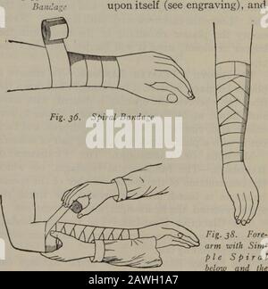 Praktische Krankenpflege: Ein Textbuch für Krankenschwestern . -Chlorsäure, Essig oder Peroxid aus Wasserstoff und mit einem Pflastermesser oder einer starken Schere versehen. Methoden des Verbands. Die FundamentalBandages - Die fundamentalen Bandagen, auf denen der Aufbau der größeren Anzahl der Specialgruppen basiert, sind das Zirkular, die Spirale, die Schlägerei umgekehrt, die Zahl-acht und die Rezidivierung. Der Kreisverband.-Die kreisförmigen Bandagekonsisten von zwei oder drei kreisförmigen Windungen, die jeweils um die Abdeckung des vorhergehenden drehen. Die Spiralbandage.-Die Spiralbandage kann nur auf Teile der Uniform c angewendet werden Stockfoto