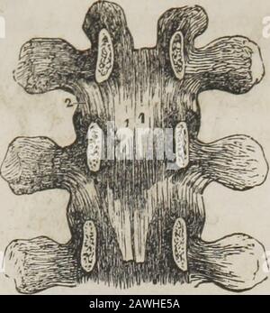Ein System der menschlichen Anatomie, allgemein und speziell . E natürliche Kurven der Wirbelsäule. Wenn die Bandsubstanz horizontal oder vertikal halbiert wird, besteht sie aus einer Reihe von Densefibrusgewebe-Schichten, die durch mit der weicheren Art gefüllte Zwischenräume getrennt sind.Der zentrale Teil jeder Bandscheibe besteht vollständig aus Thissweichem Faserknorpel. Das das Aussehen eines Zellstoffs hat und so seidig ist, dass es über die Ebene des Schnitts steigt, sobald seine Divisionierung abgeschlossen ist. Bei der Untersuchung von vorne werden die Schichten * EINER posterioren Ansicht des gefunden Stockfoto