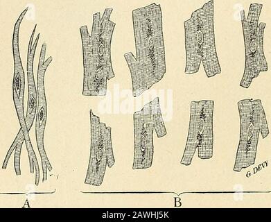 Traité d'Anatomie humaine. Omme ces derniers, délimitées par des surfaces brisées, disposées en escalier. Enfin, de leur surface latérale ou de leurs bases séchap-pent des prolongements anastomotiques plus ou moins nombreux, plus ou moinslongs et plus ou moins larges, qui se fusionnent, après un trajet variable, avec lesegges voisins. Quelle que soit leur forme, les segments de Weissmann nousoffrent à considérer, chacun, les trois parties suivantes: 1   sa Masse contractile; 2 Grad Sohn noyau; 3 Grad Sohn Protoplasma. Nous avons déjà dit plus Hut, et nous croyonsdevoir le rappeler ici, que la Fiber Stockfoto