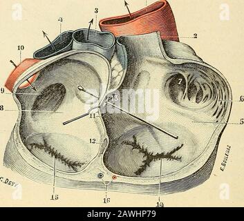 Traité d'Anatomie humaine. Lette. - 5, Orient de la grande veine coro-naire et valvule de Thébésius. - 6, Valvule tricuspide, avec 6, seskorda2:es tendineux. - 7, Drossel de lartère pulmonaire. - 7. Bran-ches de cette artère. - 8, cavité du ventricule droit. - 9, aorte. -10, tronc brachio-céphalique artériel. - 11. Carotidgauche. -11, sous-clavière gauche. .- 12, veines pulmonaires. 32 ANGÉIOLOGIE cavité dirigée en haut. SES deux extrémités ou cornes se continuent: La postericure,avec la paroi externe de la veine cave; lantérieure, avec la partie antéro-inférieurcde lanneau de Yieussens. - Stockfoto