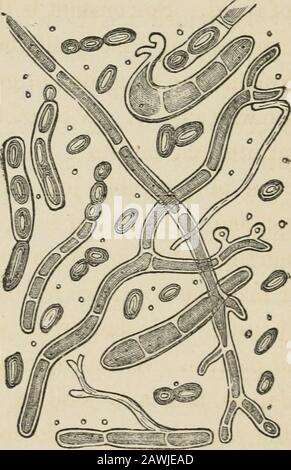 Tierische und pflanzliche Parasiten der menschlichen Haut und Haare . Positionen, wird ein Brownishspot gesehen. 2. JSporidia oder Sporenschnüre, lookinglike a Rosary. 3. TJiaJIus Fasern^ wie sie genannt werden - das heißt lange, im Allgemeinen ziemlich gerade, Fasern, mit doppelten parallelen Umrissen. Abbildung 8 stellt diese verschiedenen Elemente und ihre Entwicklungsart dar, die wie folgt ist: Zuerst nimmt eine lange Thallusfaser an der Länge zu, dann sehen wir Kontraktionen an mehreren difiTerent Punkten, geben ihm das Aussehen eines Rosars und schließlich durch weitere Kontraktion werden die einzelnen Sporen frei.Variety im Verwandten Stockfoto