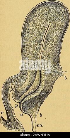 Diagnose, Pathologie und Therapeut der Frauen-Kliniken. ERSCHEIDEN, welche derSonde das Vorderdringen whren könnten. Die Spitze des Instrumentes kann bei einer der Lacunae oder der Ver-tiefungen des Cervix uteri fangen sein; Dies ist eine der größten und größten Unternehmen, die sich durch die Arbeit und die Vorgeschichte in eine rätselhafte Richtung bewegen. Es kann eine Curvatur oder einen Son-stige Richtsabkehr des Us-Instruments stoppen Stockfoto