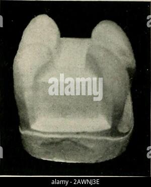 Technik und Umfang von Gussgold- und Porzellaneinlagen; mit einem Kapitel über Endokrinodontien oder die duktlosen Drüsen - ihre Expression im menschlichen Mund. Fio. 7ii Fia-. ALSO. Fio-. 81. Stockfoto