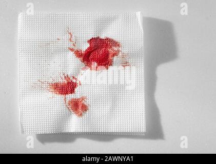 Küchenpapier Serviette im Blut. Blut mit improvisierten Mitteln stoppen. Stockfoto