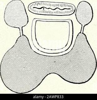 Chirurgische Therapeutika und operative Technik . Abb. 319.-Parenchymatus Goitre ofIsthmus und Left Lobe. Abb. 320.-Bilateral parenchy-matous Goitre. ARBEITEN AM HALS 195. Stockfoto