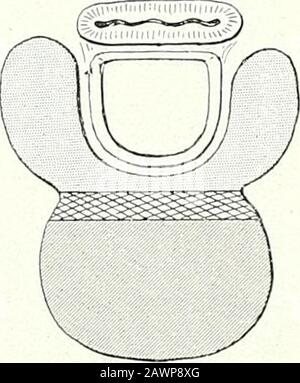 Chirurgische Therapeutika und operative Technik . Abb. 317.-Ukilateral Parenchy-matous Goitre. Abb. 318.-Median Parenchy-matous Goitre. Stockfoto