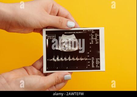 Ultraschalluntersuchung eines gesunden Babys bei Schwangerschaftsuntersuchung Stockfoto