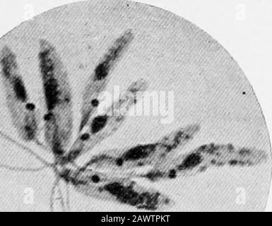 Grundlagen der Bakteriologie; eine kurze und systematische Einführung in die Untersuchung von Bakterien und verwandten Mikroörganismus. E dünne Teile des Abstrich. Der Körper des malariellen Parasiten ist blau gefleckt, seine Chromatina lilac bis rot. Die roten Zellen sind orange-rosa. Wenn möglich, sollten Untersuchungen für malarielle Organismen immer durchgeführt werden, bevor Chinin verabreicht wird. Trypanosomata.-Trypanosomen sind im Blut verschiedener Tiere flagellate Protozoafound und verursachen eine Vielzahl von Krankheiten, wie Surra, Dourin und Nagana, Affektingpferde und Rind, vor allem in tropischen Ländern, an Stockfoto