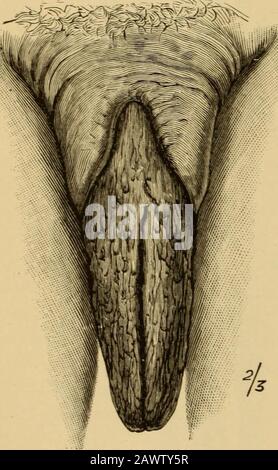 Jinsiy aloqa tosh bolganda