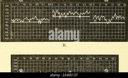 Narkologie: Ein Handbuch der Wissenschaft über die allgemeine und lokale Schlagerei: In 2 Bänden mit zahnlichen Abbildern . iplMJLiijäjJ^umUyM "?JMI^vmmsiäMHI????????? iüHHHnBÜiBUBBEHHa??????????????????????????????????????????????????????????????? Blutdruckkurven in der komplexen Chloroforrather-Sauerstoffnarkose. A. Blutdruckkurve in der Äther-phloroform-Sauerstoffuarkose unter Schema-tischer Darrung des Äthers bei A und Chloroform bei C.Blutdruckkurveu in der Äther-Chloroform-Sauerstoftnarkose bei ExakterLeitung. C. B. Stockfoto