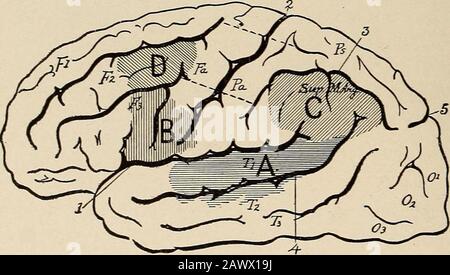 Nervöse und psychische Erkrankungen. En und geschrieben. Die ersten sind afferente Wahrnehmungsqualitäten. Die zweiten beiden sind Efferentqualitäten des Ausdrucks. Wir haben daher vier Wortgruppen: (1) Solche von Ton oder Hörvermögen; (2) solche von Sicht oder visuell;(3) solche von Bewegungen, die notwendig sind, um Worte in Sprache, Sprache und Sprache auszudrücken, und (4) wahrscheinlich die Bewegungen, die erforderlich sind, um diese durch schriftliche Symbole, Grafikmotor auszudrücken. Für diese vier Gruppen havefour kortikale Bereiche, wie in Abb. gezeigt. 71, S. 174, wo diese Wortmerkmale hauptsächlich dargestellt werden. Der Sprechbereich von Stockfoto