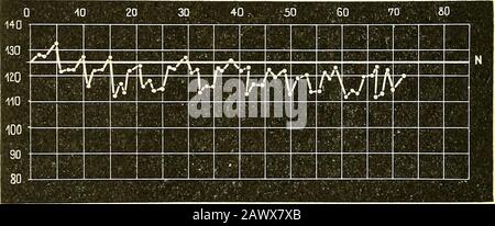 Narkologie : ein Handbuch der Wissenschaft über die allgemeine und lokale Schlagerei (Narkosen und Methoden der lokalen Anasthesie) : in 2 Bänden mit zahreichen Abbildern . Kurz B. Kurz C. Fiff. 155. Blutdruckkurven in der Chlorofoimsaueistoffuarkose.N =^ Normalblutdruckhöhe. Ether- und Chloroformnarkosen zu können, habe ich bei Mehrerenkrankungen mit dem Gärtnerschen Tonometer Versche Angestellt, welche dasResultat geliefert haben, da der Blutdruck allerdings eine Depression in derToleranz erfehrt, so daß der Kandidat und der Kandidat der Charstelle Stockfoto