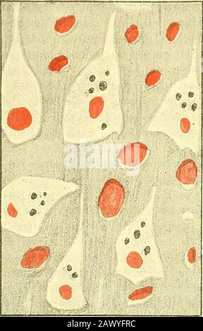 Narkologie: Ein Handbuch der Wissenschaft über die allgemeine und lokale Schlagertätigkeit (Narkosen und Methoden der lokalen Anästhesie) : in 2 Bänden mit zahlenen Abbildern . e Lähmunden anderer Gehrnabzeichen wurden Schäden am eigenen Standort oder am Boden des Schäfers durchgeführt. Ein Teil der Narkosenläser ist auf eine zentrale Lähmung der Nervenzentren durch die Chloroformwirkung zu rühren.Es hat sich närmlich nach Chloroformnarkosen in den Ganglienzellen imGehirn Fettmetamorphose nachwelassen (Verf). Nach Länderen undöften Chloroformnarkosen Stockfoto