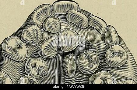 Die Ätiologie der osseösen Deformitäten von Kopf, Gesicht, Kiefer und Zähnen. Stockfoto