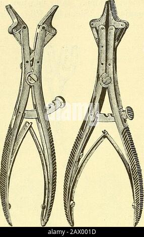 Narkologie : ein Handbuch der Wissenschaft über die allgemeine und lokale Schlagerei (Narkosen und Methoden der lokalen Anasthesie) : in 2 Bänden mit zahreichen Abbildern . Abb. 79. Zungenzangenach Mathieu. Abb. 80. Zungenzangenach Champonniere. Abb. 81. Zungenzangonach Könisf. - 218. Stockfoto