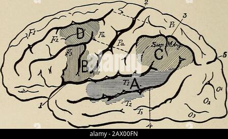 Nervöse und psychische Erkrankungen. N und geschrieben. Die ersten sind afferente Wahrnehmungsqualitäten. Die zweiten beiden sind Efferentqualitäten des Ausdrucks. Wir haben daher vier Wortgruppen: (1) Solche von Tongedächtnissen oder Hörgedächtnissen; (2) solche von Sehkraft oder visuellen Wortgedächtnissen; (3) die Bewegungen, die erforderlich sind, um Worte in Sprache, Stimmmotoren-Wortspeicher und (4) wahrscheinlich die Bewegungen auszudrücken, die erforderlich sind, um sie durch schriftliche Symbole, grafische Motorwort-Erinnerungen auszudrücken. Für diese vier Speichergruppen haben wir vier Corticalmemory-Depots, wie in Abb. dargestellt. 71. Diese Speicherwort-c Stockfoto