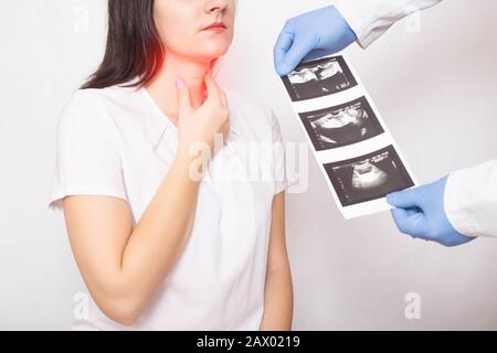 Der Doktor hält die Ergebnisse einer Schilddrüsen-Ultraschalluntersuchung eines Mädchens. Schilddrüsenkrankheiten, Knötchendrüse, Krebs Stockfoto