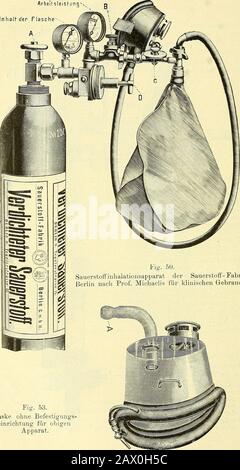 Narkologie : ein Handbuch der Wissenschaft über die allgemeine und lokale Schlagerei (Narkosen und Methoden der lokalen Anasthesie) : in 2 Bänden mit zahreichen Abbildern . 204 Arbeitsleishunq^^^Jnhalh der FlascheA. Lg. 50.Sauerstoffinlialationsapparat der Sauerstoff-FabrikBerlin nach Prof. Michaelis für klinisches Gebrauch. Abb. 53. Maske ohne Befestigungs-S einrichtung für obige Apparat. 205 Stockfoto
