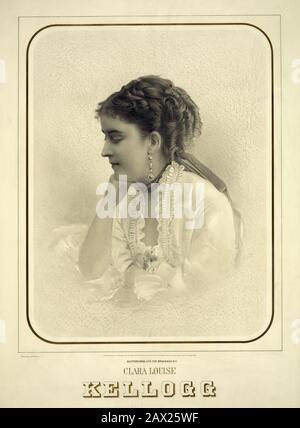 Die berühmte amerikanische Oper Diva CLARA LOUISE KELLOGG (* um 2:4; † um 13:3) . - OPERA LIRICA - DIVA - DIVINA - OPERA LIRICA - MODE - MODA - '800 - Ohrtropfen - orecchini - Chignon --- Archivio GBB Stockfoto