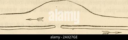 Ein Handbuch der Chirurgie: Mit fünfzig Abbildungen . AMPUTATION. 109 Nihinikat, wie bei ersteren, aber ohne jede Zyste, die sich einstellt; die Schwellung ist weniger, aber stärker diffus, und die Variosendistonie der Venen ist sehr groß. Die Extremität unter dem Tumor Abb. 36. Ist unvollkommen mit arteriellem Blut versorgt und folglich kalt, taub und lebensschwach, außerdem kann es zu Überlastung und Ödem kommen. Es ist unter Druck zu behandeln, um die Schwellung zu wiederholen und die sanguineöse Mischung zu moderieren: Dies führt zu einer Linderung der Symptome und ermöglicht die Verwendung der Extremität. Eine dauerhafte Heilung kann nur b erfolgen Stockfoto