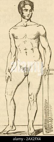 Ein Handbuch der Chirurgie: Mit fünfzig Abbildungen . Bei den häufigsten Verschiebungen nach oben und nach hinten ist die Elimbierung von anderthalb Zoll auf zweieinhalb Zoll verkürzt; die Zehen ruhen auf der gegenüberliegenden Stufe; das Knie wird nach innen gedreht und leicht gebogen; die Extremität kann über die andere Seite gebogen werden, kann aber nicht nach außen gebogt werden; Der Trochanter ist weniger prominent und näher an der Darmbein; und wenn der Patient dünn ist und kein Schwellen vorhanden ist, kann der Kopf des Knochens in seiner neuen Position gefühlt werden, und die Hüftform geht verloren. Er ist von der Nacktafraktur zu unterscheiden Stockfoto