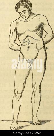 Ein Handbuch der Chirurgie: Mit fünfzig Abbildungen . VERORTUNG DES OBERSCHENKELS. 59 nach unten und nach unten, in das Foramen ovale (Abb. 15); 3d, nach hinten, in die ischiatische Kerbe (Abb. 16); 4., nach oben und nach unten, auf dem horizontalen Amoklauf der Pubes (Abb. 17); 5., nach unten, unter der Tuberosität des Ischiums. Die erste ist die fünfte Mostthe die seltenste. Häufig, Abb. 16. Abb. 17. Stockfoto