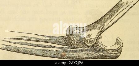 Ein Handbuch der Chirurgie: Mit fünfzig Abbildungen . Ion sehr langsam gemacht werden. Der Ellenbogen hat diesen Vorteil gegenüber dem Handgelenk, da ein Punkt der Anbringung des verlängerten Bandes, der Ellenbogen kann gebogen werden, und damit eine angenehme rotatorische Bewegung des Knochenkopfes. Thewrist wird von einigen bevorzugt, da es keine Musklesekomprimierten gibt, deren Kontraktion die Reduktion stören könnte. Nach der Reduktion, die durch das Absetzen von Schmerzen, die Rotheit der Schulter und die Beweglichkeit der Extremität erkannt wird, sollte sich der Arm in einer Schlinge halten und mehrere Tage lang nicht verwendet werden. Lähmung der Stockfoto