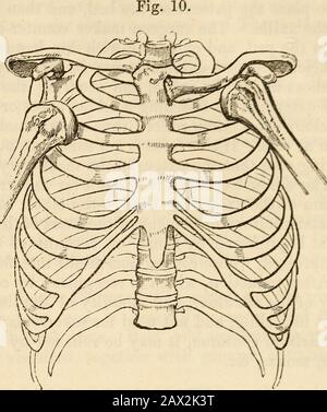 Ein Handbuch der Chirurgie: Mit fünfzig Abbildungen . n Verortung nach unten, was die häufigste Verstellung ist, ist der Arm verlängert, und es gibt eine große Steifigkeit und VERORTUNG DES ARMS. 55 Unbeweglichkeit; der Elbowrack hebt sich vom Körper ab; es gibt einen Tiefststand unter dem Acro-mion-Prozess und eine Hervorhebung in Theaxilla. Bei der Verstellung nach hinten, d. H. Bei Mostrare, ist der Ellenbogen nach innen und nach unten geklingt, der Kopf des Knochens bildet eine Promigence unter dem Pespin der Scapula, und es gibt einen Hohlraum unter dem Akromion, zusammen mit Härte und Unbeweglichkeit. Gewalt und Antraktion des Mus- Stockfoto