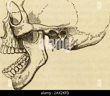 Ein Handbuch der Chirurgie: Mit fünfzig Abbildungen . tionen Toremove swelliDg und Schmerz. Danach kann, falls noch Steifigkeit vorhanden ist, die Reibung stimuliert werden. Die Subsulation impliziert eine teilweise Entfernung des Kopfes einer artikulierenden knochenfroman-oberfläche. Die Begriffe "kürzlich" und "alt" beziehen sich auf luxa-tions mit Bezug auf den Zeitraum, der abgelaufen sein kann, und auf Änderungen, die durch Adhäsionen aufgetreten sein können, &c Zusammengesetzte Luxation.-Dies ist verbunden mit einer Wunde in den Ganzzahlen, Knochenbruch, Zerlegung großer Gefäße, &c Es gelten die thesamen Prinzipien wie bei der zusammengesetzten Fraktur. Die gleichen Gefälle von Stockfoto