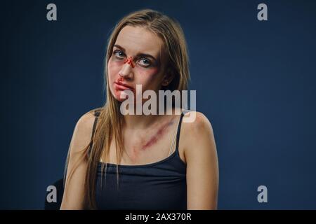 Betrübt blondes Mädchen in schwarzem Unterhemd. Blutendes Gesicht mit Prellungen bedeckt, mit Blick auf die Kamera, vor blauem Hintergrund sitzend. Häusliche Gewalt Stockfoto