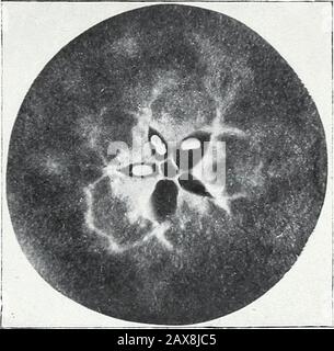 Untersuchungen zu Äpfeln: IStorage, Atmung und Wachstum; IIunlösliche Kohlenhydrate oder marc; IIImikroskopische und makroskopische Untersuchungen von apfelstärke . Abb. 1.-18. August 1903. Abb. 2.-25. September 1903. Stockfoto