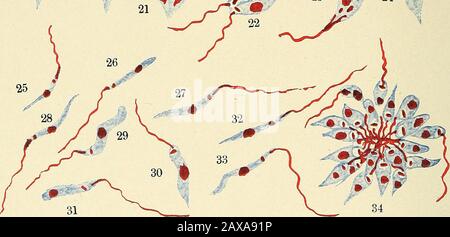 Die Malariafieber, das hämoglobinurische Fieber und das Blutprotozoa des Menschen. W^ 20 .^ m ^0 • ^S 18. Stockfoto