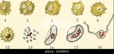 Die Malariafieber, das hämoglobinurische Fieber und das Blutprotozoa des Menschen. 11. Quotidian Aestivo-herbstliches Plasmodium. Stockfoto