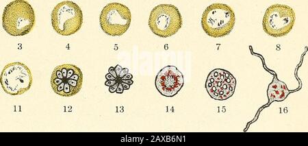 Die Malariafieber, das hämoglobinurische Fieber und das Blutprotozoa des Menschen. 9 5 ?-^-^^^: Tertian Plasmodium.. Quaran Plasmodium. Stockfoto