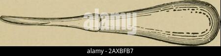 Angewandte Anatomie und Mundchirurgie für Zahnmediziner. Abb. 35.-A, untere molare Pinzette; B, Universelle obere Pinzette (Cryer); C, Universelle untere Pinzette (Cryer). Abb. 36.-Nr. 3 Aufzugszubehör ist für schwerere Arbeiten als der Entalmotor vorgesehen. Sägen, Trephinen, Bohrer und Grate in verschiedenen 154 ORALEN CHIRURGISCHEN Größen und Formen können so hergestellt werden, dass sie auf das Handstück passen. Der Motor kann von Hand oder von einem Elektromotor angetrieben werden. Stockfoto