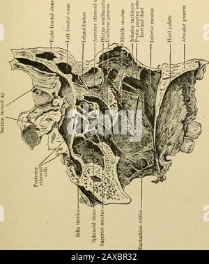 Angewandte Anatomie und orale Chirurgie für Zahnmediziner . n, die Kresten der Maxillen- und Gaumenknochen, Therostrum des Sphenoids und die Nasenrücken der Stirnbein helfen bei der Bildung der Nasenscheidewand (Abb. 8). Die Knochen, die in die Bildung der Lateralwand der Nasenkammer eintreten, sind: Die nasalen, die nasalen Prozesse der Maxillare, die Lacrimale, das Ethmoid, die inferiorturbinierten, der Gaumen und der Pterygoid-Prozess undbody des Sphenoids. Der unterste trurbinierte Knochen und die Turbinatedprozesse des Ethmoidknochens teilen die Seitenwand der Nasenkammer in mehrere Horizonte Stockfoto