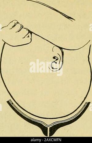 Die Praxis der Geburtshilfe, die für den Gebrauch von Studenten und Ärzten der Medizin entwickelt wurde. Stockfoto