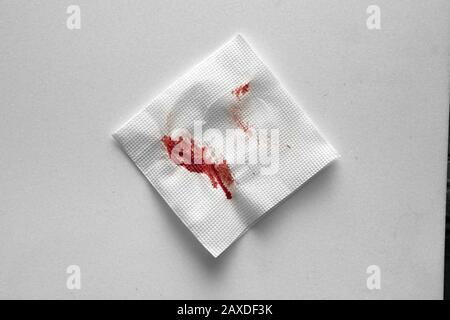 Küchenpapier Serviette im Blut. Blut mit improvisierten Mitteln stoppen. Stockfoto