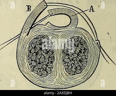 Manuel de médecine opératoire . Abb. 620.Tracé des lambeaux. Abb. 621. Rapports des lamheaux. Avivée, et ces deux lambeaux furent maintenus adossés au moyendune suture entortillée (Abb. 618). Stockfoto