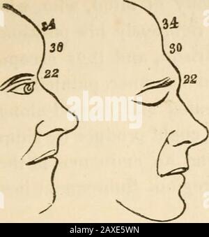 Vorträge über die Phrenologie, einschließlich ihrer Anwendung auf den gegenwärtigen und zukünftigen Zustand der Vereinigten Staaten. Tinten Thisorgan ist manchmal einzeln erkrankt, in Fällen, in denen Wordsare unaufhörlich ohne Bedeutung oder kohärent gesendet werden.Ärzte sollten vorsichtig sein, Daher, zwischen Handlungen und Ausdrücken zu unterscheiden, in ihren Untersuchungen und Zeugenaussagen über Fälle von Unsanklichkeit. Er denkt, dass die Manifestation dessen, was man als Geschenk des Mandelringenten unter den Irvingiten und anderen bezeichnet, zum Teil von der Entrangigung dieses Organs abhängt. Dass das Gehirn derangiert ist, zeigt sich unmissverständlich Stockfoto