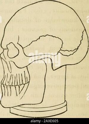 Vorträge über die Phrenologie, einschließlich ihrer Anwendung auf den gegenwärtigen und zukünftigen Zustand der Vereinigten Staaten. Minuten lang galt als ungewöhnlich. KOMBINATIONEN AUS PROPENSITÄTEN UND EMPFINDUNGEN. Die Köpfe können in 10 drei Klassen eingeteilt werden: 1. Wie etwa die Moralgefühle und der Intellekt unvorstellig haben, wie im Totenkopf von Spurzheim. 2. Wie etwa die Pro-Pensitäten, den moralischen Sentimentsand Intellekt, fast im Equi-Librium. 3. Wie haben die Pro-Pensitäten im Übergewicht. Wenn Sie diesen Kopf betrachten, sehen Sie große moralische Empfindungen, große intellektuelle Fähigkeiten und volle Propensitäten. Eine Person Stockfoto