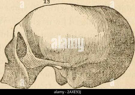 Vorträge über die Phrenologie, einschließlich ihrer Anwendung auf den gegenwärtigen und zukünftigen Zustand der Vereinigten Staaten . Hingabe, dieser Herr, mit vierhundert AnderWhites, wurden vor dem Massaker von General gerettet, und das Vermögen von M. Belin wurde mehrere Stunden bewahrt. In Paris waren die Gewinne seiner Industrie und seiner Therewards alle in der Linderung des Elenden beschäftigt. In Port au Prince hörte er oft, wie sein Meister, der ein alter Mann war, die allmähliche Schwächung der Zischaugen beklagt. Eustache konnte nicht lesen, aber, inspiriert von dem hoffnungsvollen gefallen an seinem Meister, wandte er sich heimlich an das Studium, an Stockfoto