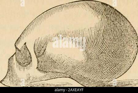 Vorträge über die Phrenologie, einschließlich ihrer Anwendung auf den gegenwärtigen und zukünftigen Zustand der Vereinigten Staaten . [1] Altgriechische Sprache. [2] neuer Hollander. Pare es mit dem eines Altgriechischen [1] oder mit dem des Anitaliens: Der Unterschied zu Letzterem ist enorm!Dieser italienische Schädel, der bekanntermaßen mindestens zweihundert Jahre verkauft war, sollte der von Raphael sein und wurde in der St. Lukes Akademie in Rom als solcher konserviert; aber wie Raphaelsschädel vor kurzem entdeckt wurde, sagen Verweigerer, dass dieser Thisfehler die Phrenologie zurückweist. Alles, was sie aus Thekase machen können, ist aber, dass es nicht gehörte Stockfoto