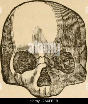 Vorträge über die Phrenologie, einschließlich der Anwendung auf den gegenwärtigen und zukünftigen Zustand der Vereinigten Staaten. Gemeinsame Verwendung von Materialien, Abplatzen von Frag-ments, Formgebung, Zeichnen von Linien und Verlegen von Farben. Sie erfindet nicht: Sondern sie modelt oder stellt sich vor, wenn sie groß ist, dann aber das verstehen anregt, zu erfinden, was sie beim Konstruieren wohltuend einsetzen wird.Sie nimmt ihre Richtung von den anderen Fachbereichen. Mit großem Gewicht führt es zur maschinellen Herstellung, WithIdealität und Form, zur Statuary; mit diesen und Color, zum Topainting. Vergleichen Sie diese Köpfe: In diesem von Stockfoto