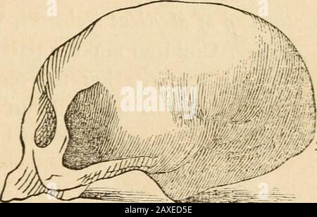 Vorträge über die Phrenologie, einschließlich ihrer Anwendung auf den gegenwärtigen und zukünftigen Zustand der Vereinigten Staaten . --(Combe.)Außerdem widerspricht sie oft der Vernunft bei Spoilingkindern.-(Spurzheim.) Und wir finden sie in voller Kraft unter den intellektuellsten der Menschheit und den mostferen Bruten. Einwand. Die Liebe zum Nachwuchs entsteht durch Freundlichkeit und Wohlwollen der Disposition. Antwort. In diesem Fall sollte kein egoistischer Mensch Kinder lieben, aber Personen, die wegen Wildheit und Blutdürstigkeit festgestellt wurden, sind oft stark an den Kiefernfrüchten befestigt. The Char Stockfoto