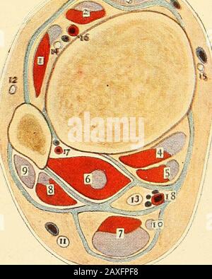 Ein Handbuch der operativen Chirurgie. ^fe ABB. 1. -ABSCHNITT DES RECHTEN BEINS IN DER MITTE. 1, TIBIALIS ANTICUS MUSCULUS 2, EXTENSOR DIGITORUM. 3, EXTENSOR LONGUS HALLUCIS. 4,TIBIALIS POSTICUS. 5, PERONEI-MUSKELN. 6, FLEXOR LONGUS HALLUCIS. 7, 8, 10, SOLEUS.9, FLEXOR LONGUS DIGITORUM. 11, GASTROCNEMIUS. 12, MUSCULO-CUTAN EOUS-NERV. 13, NERVUS ANTERIORTIBIAL. 14, NERVUS TIBIALIS POSTERIOR. 15, INNERER SAPHENÖSER NERV. 16, NERVUS SHORTSAPHENOUS. 17, NERVUS MMUNICANS PERONEI. 18, ARTERIA TIBIALIS POSTERIOR. 19, AN-TERIOR TIBIAL ARTERIE. 20, PERONEALARTERIE UND VENEN. ABB. 2-ER ABSCHNITT DES BEINS DIREKT ÜBER DEM ANK Stockfoto