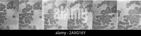 Wissenschaftlicher amerikanischer Band 77 Nummer 05 (Juli 1897) . k totthe glass; während die roten Zellen wahrgenommen werden, retainsomething of their motion, fortfährt, acrossthe field für eine halbe Stunde nach der Blutentnahme zu fließen. Das Foto des Rotentropfers in einem Tropfen stagnantCroton Wasser ist die interessanteste Form der Zellbewegungsdennoch reproduziert. Dieser Rotstifer bewegt sich mit etwa einer Fliege auf dem Flügel, und jede Aktion wird mit einer Geschwindigkeit von etwa 2.500 Bildern pro Minute fotografiert. Es wurden zahlreiche Aufnahmen von Bakterien gemacht, Butthe Motion war zufällig ein auf und ab und zeigte Nein Stockfoto