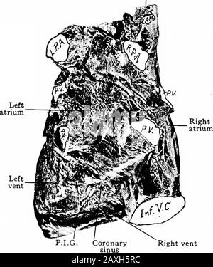 Ein Handbuch der Anatomie . (COR) ist ein hohles muskuläres Organ mit einer abgeflachten, konikalförmigen Form, das sich in der Brusthöhle befindet. Es ist in einem Seroussac enthalten, das Perikardium genannt wird. Etwa ein Drittel liegt rechts von der Brustlinie und zwei Drittel links. Seine lange Achse ist nach links und nach vorne (Vantrad) nach unten (Caudad) gerichtet. Seine Dimen - 2l6 DIE BLUTGEFÄSSSYSTEMSIDIEN sind 12,5 cm lang, 8,75 cm breit und 6,25 cm dick. Er wiegt 10 bis 12 Unzen beim Männchen und 8 bis 10 Unzen beim Weibchen. Es zeigt eine Basis, einen Apex, zwei Flächen und zwei Ränder. Stockfoto