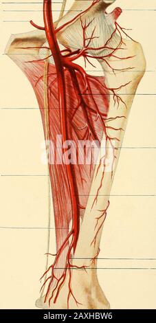 Ein Handbuch der operativen Chirurgie. Iin. Reflektierter TENDONOF RECTUS EXTERNER ARTERIA CIRCA-FLEX TIEFE FEMORALARTIR ADDUCTOR MAGNUS FEMORAL ARTERIA  ARTERIA ANASTOMOTICAj MAGNA DIE FEMORALARTERIEN MIT IHREN HAUPTÄSTEN (Seite 410).(Von einer Dissektion im London Hospital Museum.) EIN HANDBUCH VON O PRO ATIVESURGENY VON SIR FREDERICK TREVES, Bart. G:C. V.O., C. B., LL.D., F.R.C.S.K. Serjeant-Surgeon an H.RI. The King, Surgeon-in-Ordinary to H.R.H. the Princeof Wales, Consulting Surgeon to the London Hospital AND JONATHAN HUTCHINSON, F.R.C.S.K. Chirurg an und Dozent für Chirurgie am London Hospital, Examis Stockfoto