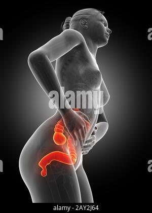 Medizinische 3D-Darstellung - Frau mit Schmerzen im Bauch Stockfoto